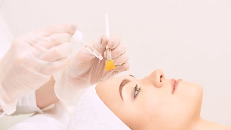 Chemische Peeling