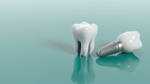 Implantat