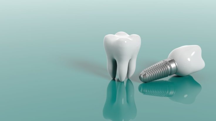 Implantat
