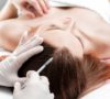 La Mesoterapia Capilar