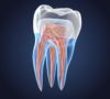 Endodonti (Kanal Tedavisi)